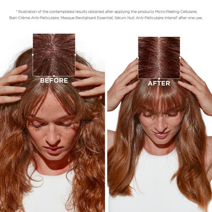 Kerastase Micro-Peeling Cellulaire