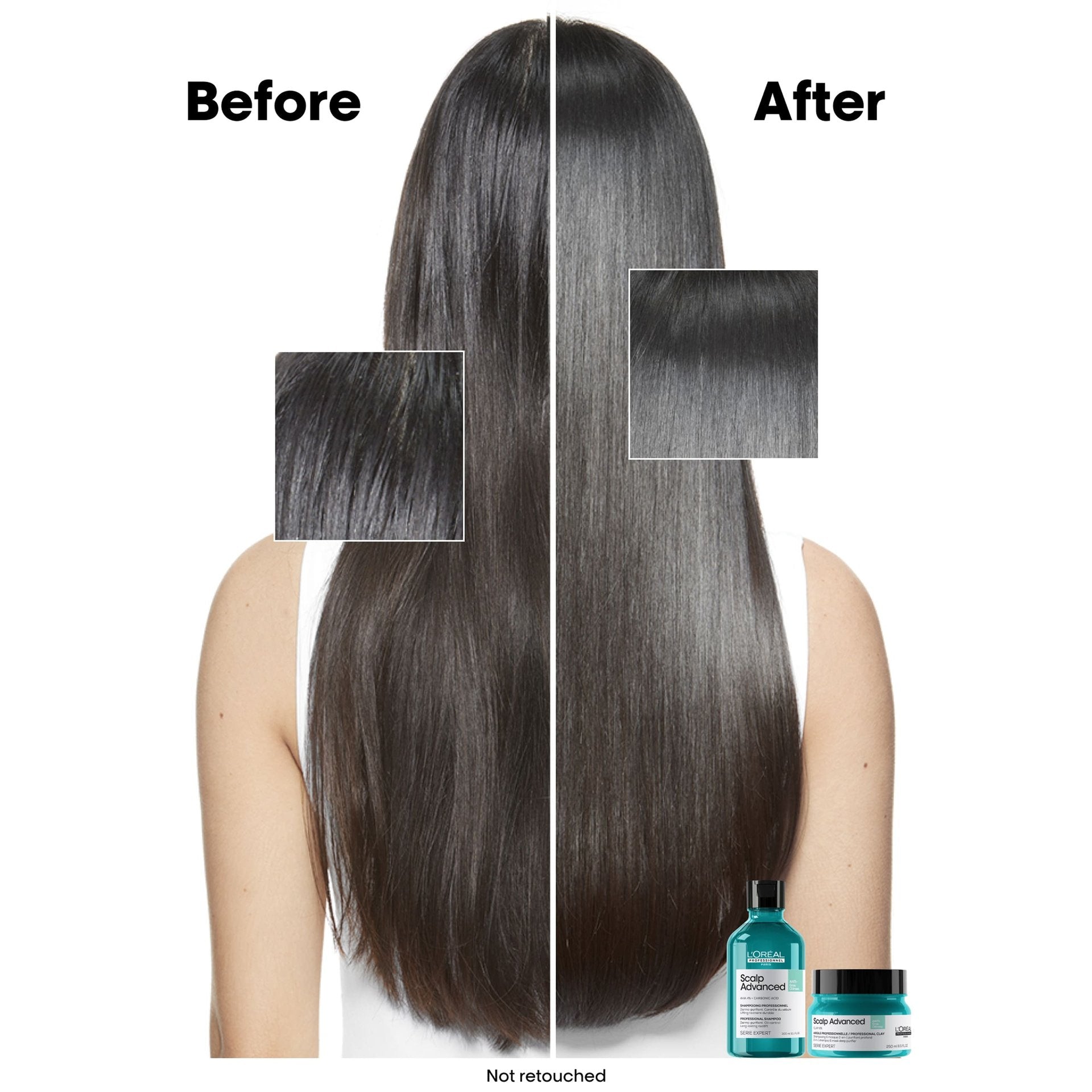 Anti-Oiliness Shampoo